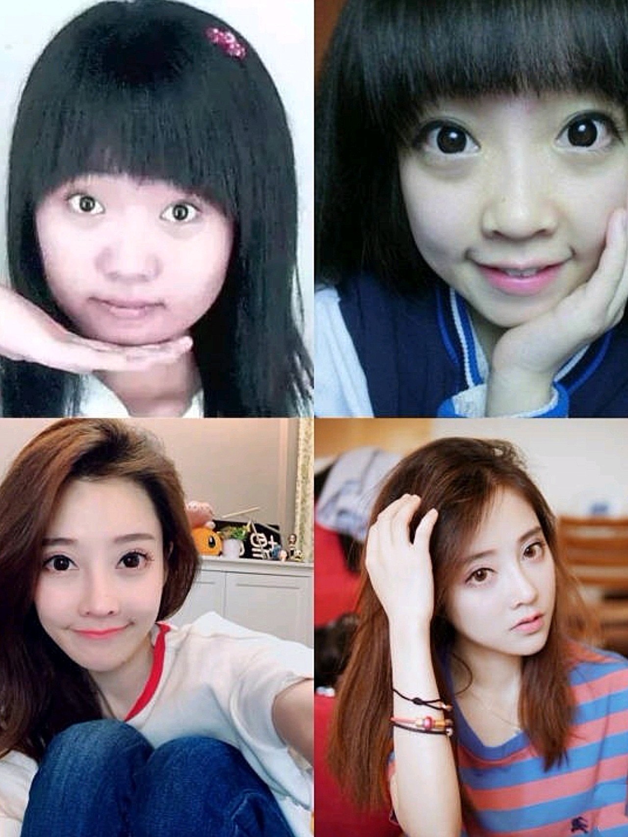 昨天写了菲菲公主的整容史,很多姐妹有被笑到