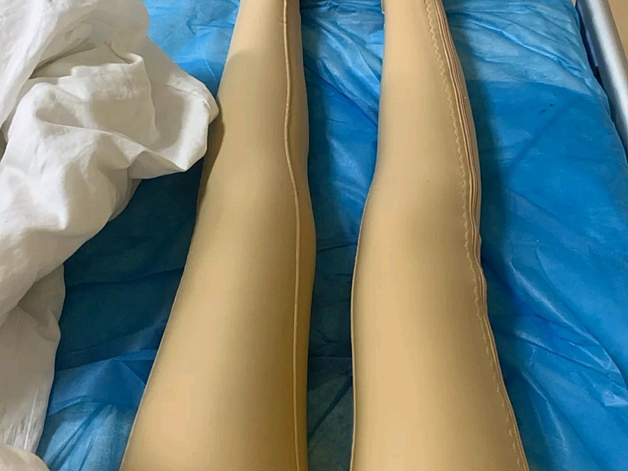 做完到现在大腿腿围已经45cm了.美女们做完之后要_圈子-新氧美容整形