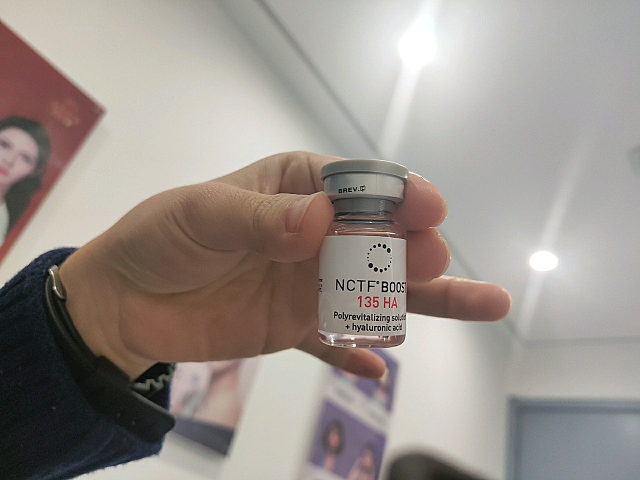 郭医生手针打菲洛嘉技术很棒,很有耐心,护士辉辉很贴_圈子-新氧美容