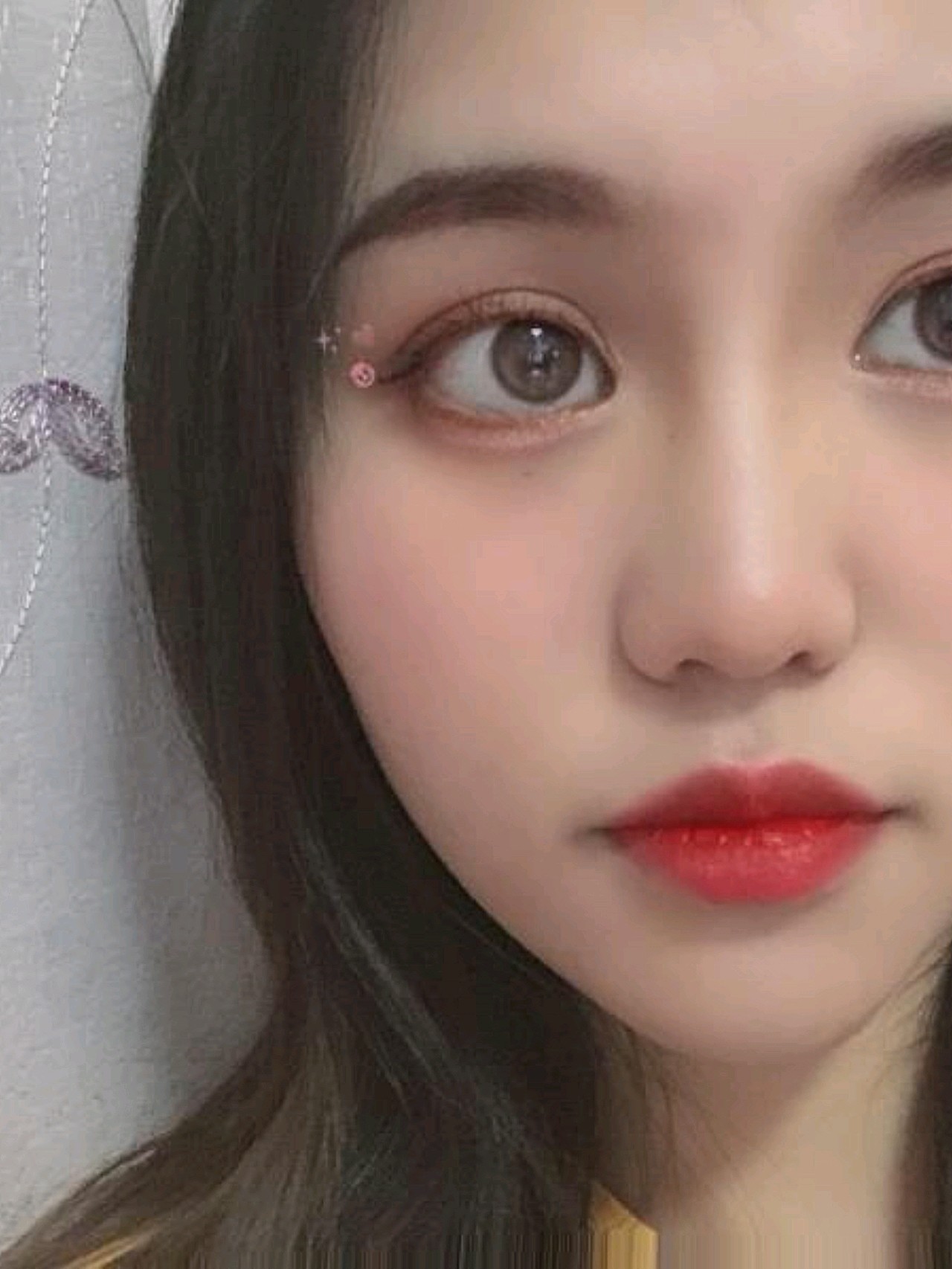 因为眼睛圆,远距离拍照眼睛太有喜感,一直想做外眼角_圈子-新氧美容