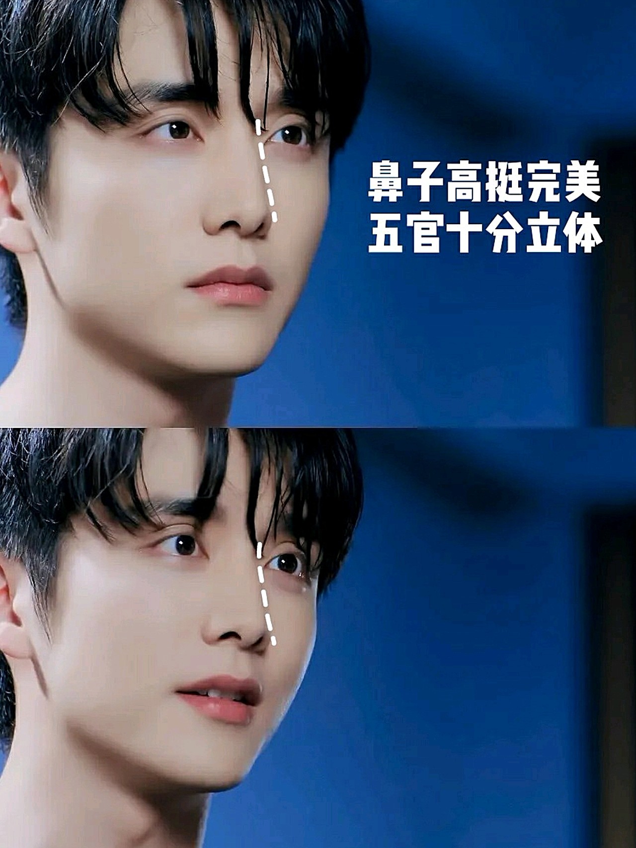 张新成拥有一双星星眼,卧蚕饱满眼睛很大,十分有神.