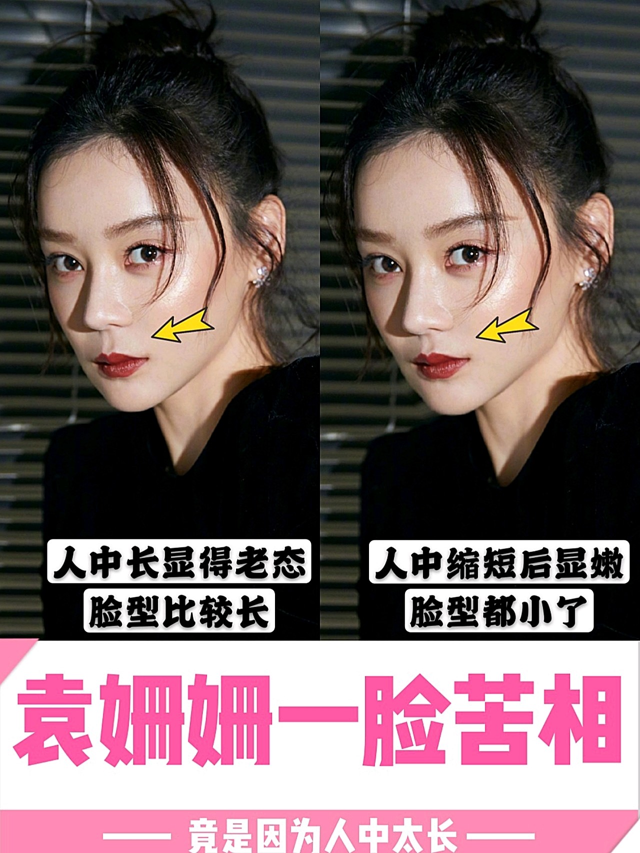 袁姗姗一脸苦相竟是因为人中太长