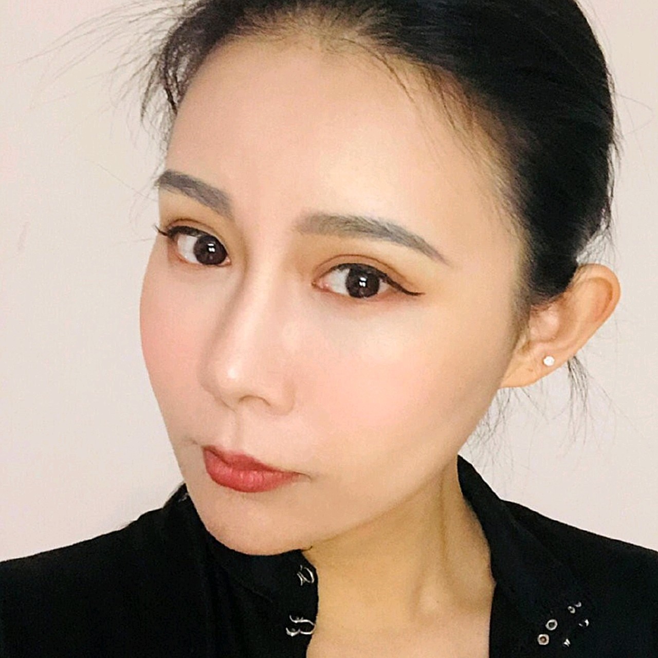 其实脸部额头都是饱满的,只有一点法令纹,眼下也有一_圈子-新氧美容