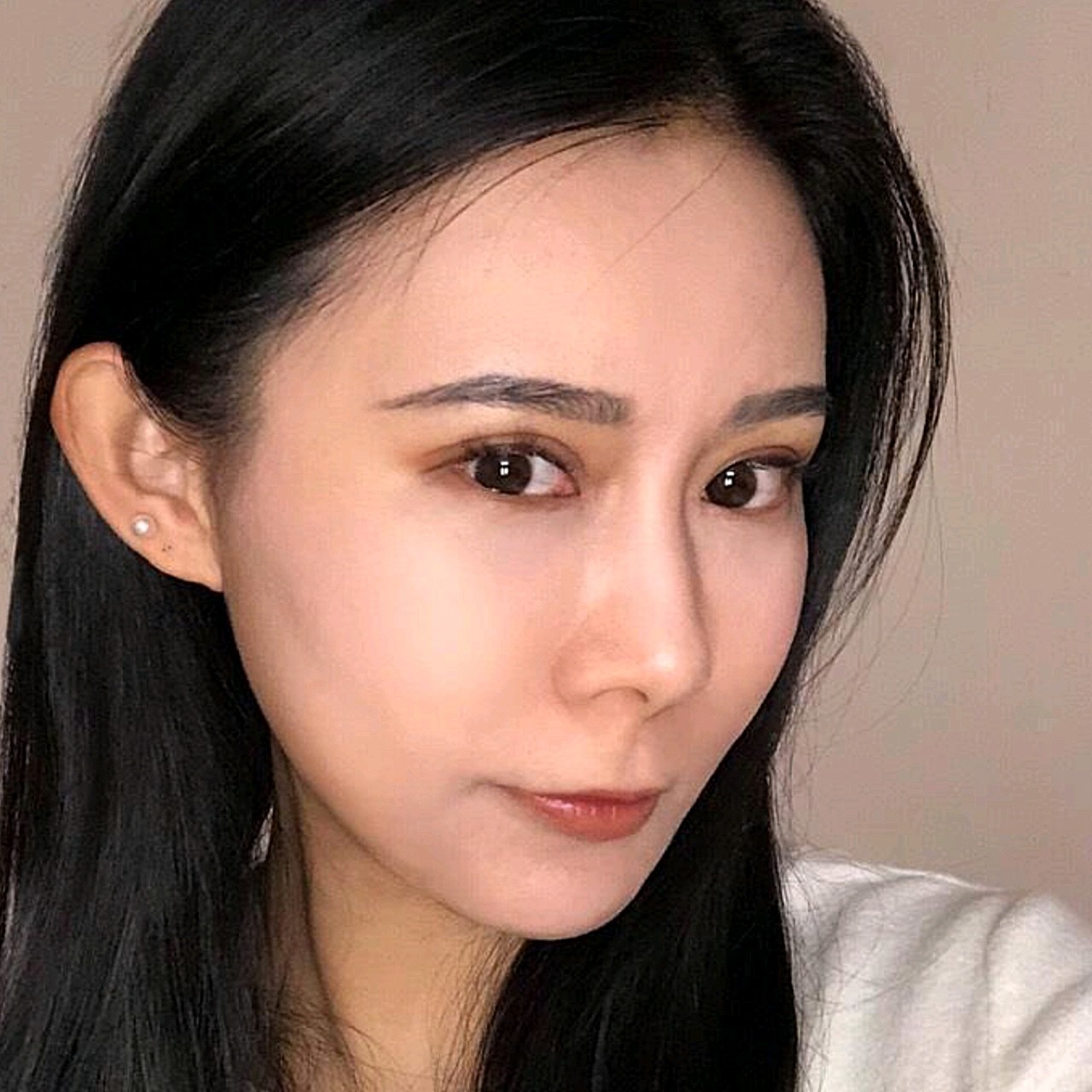 其实脸部额头都是饱满的,只有一点法令纹,眼下也有一_圈子-新氧美容