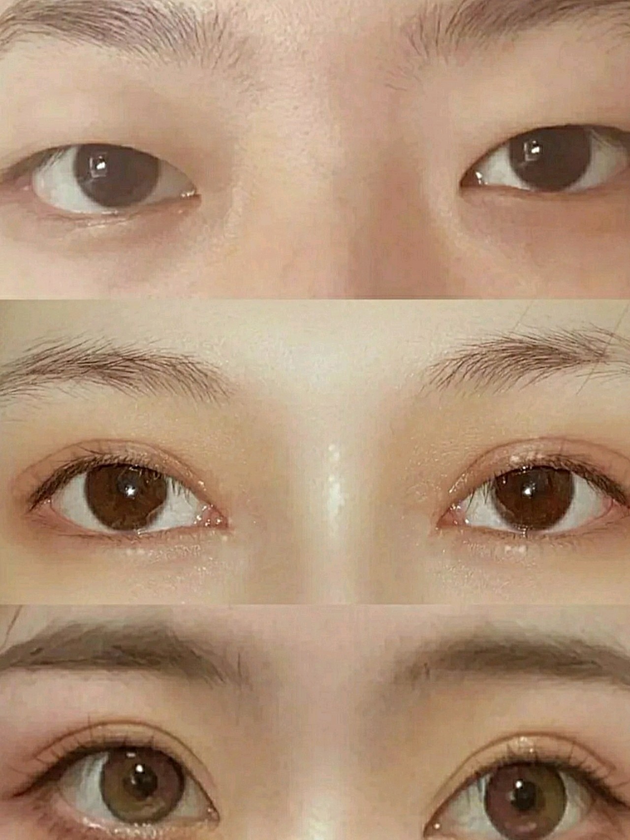 小内双的逆袭,有感觉自己做完拍照片有点像网红小姐姐_圈子-新氧美容