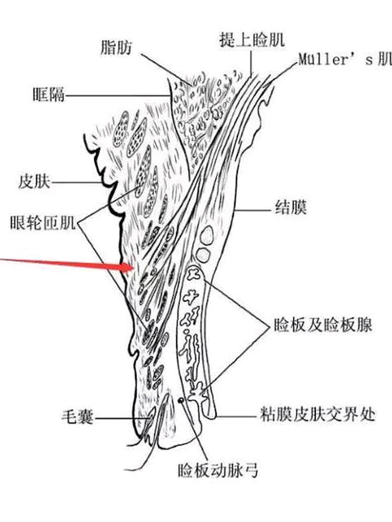 我们的眼睛皮肤以分为上睑和下睑,而我们双眼皮在医学上又称为重睑术