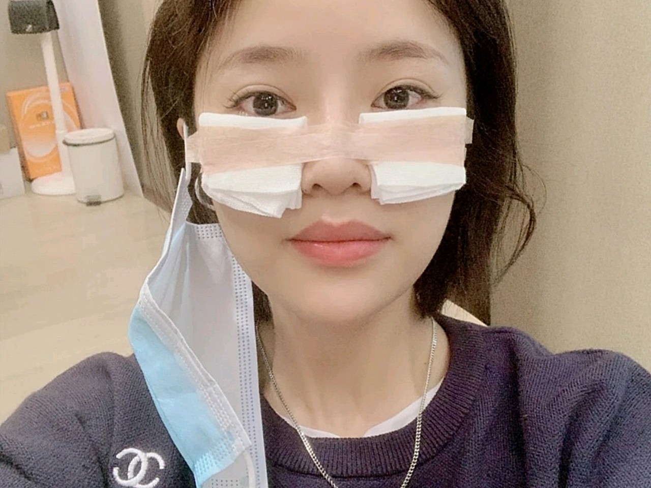 和我妈一起做的内吸眼袋,我自己的我知道,眼袋是天生_圈子-新氧美容