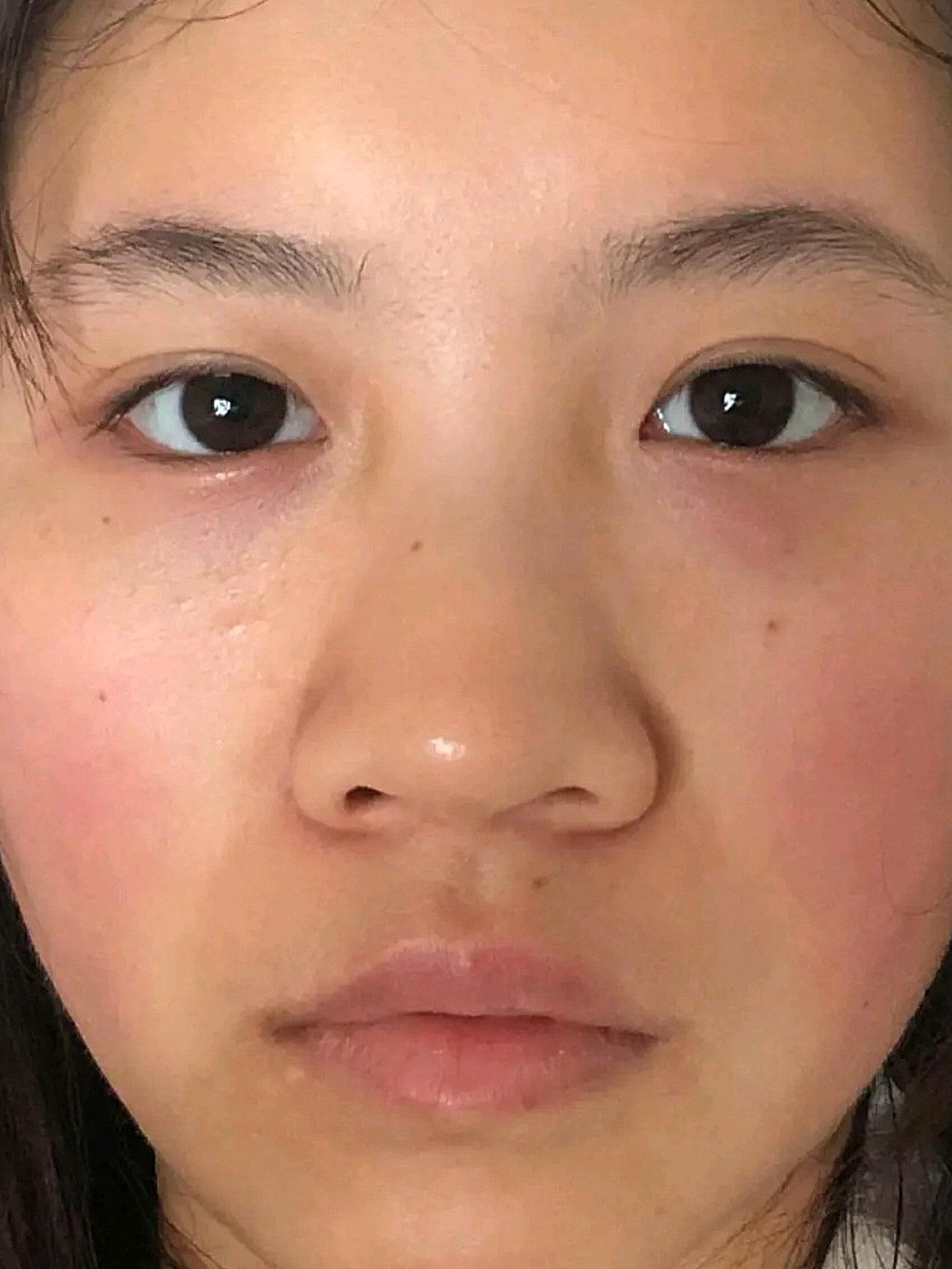 这差别这差距真的是好大呀,之前的扁鼻子91到现在的立_圈子-新氧