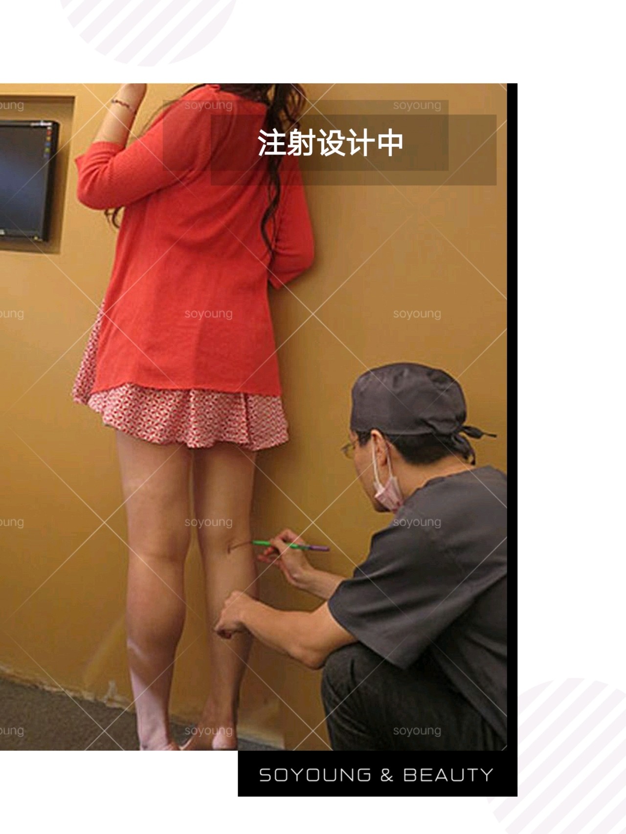 【案例分享】你与性感美腿仅差一支瘦腿针!