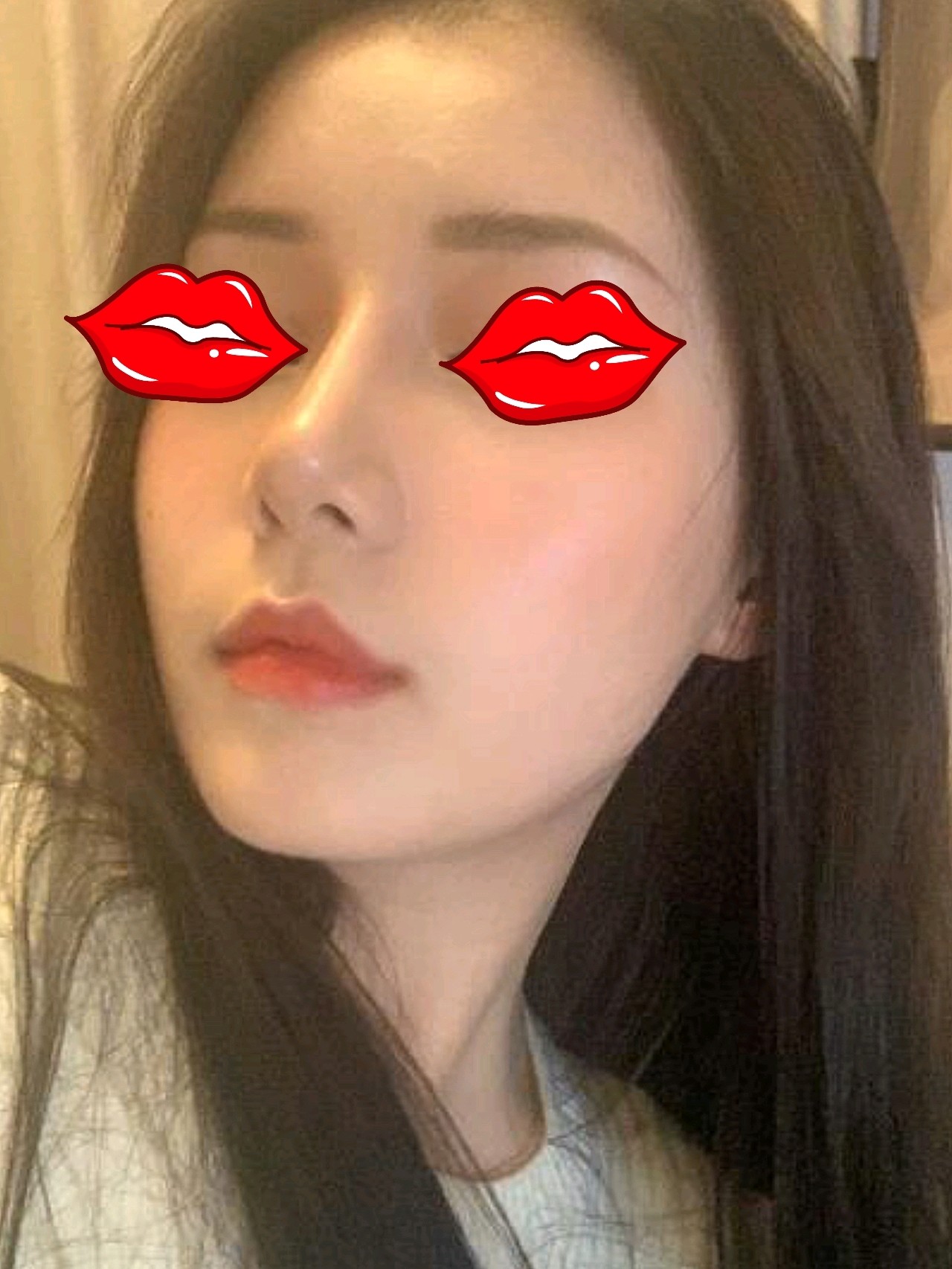 鼻部多项半肋鼻部多项