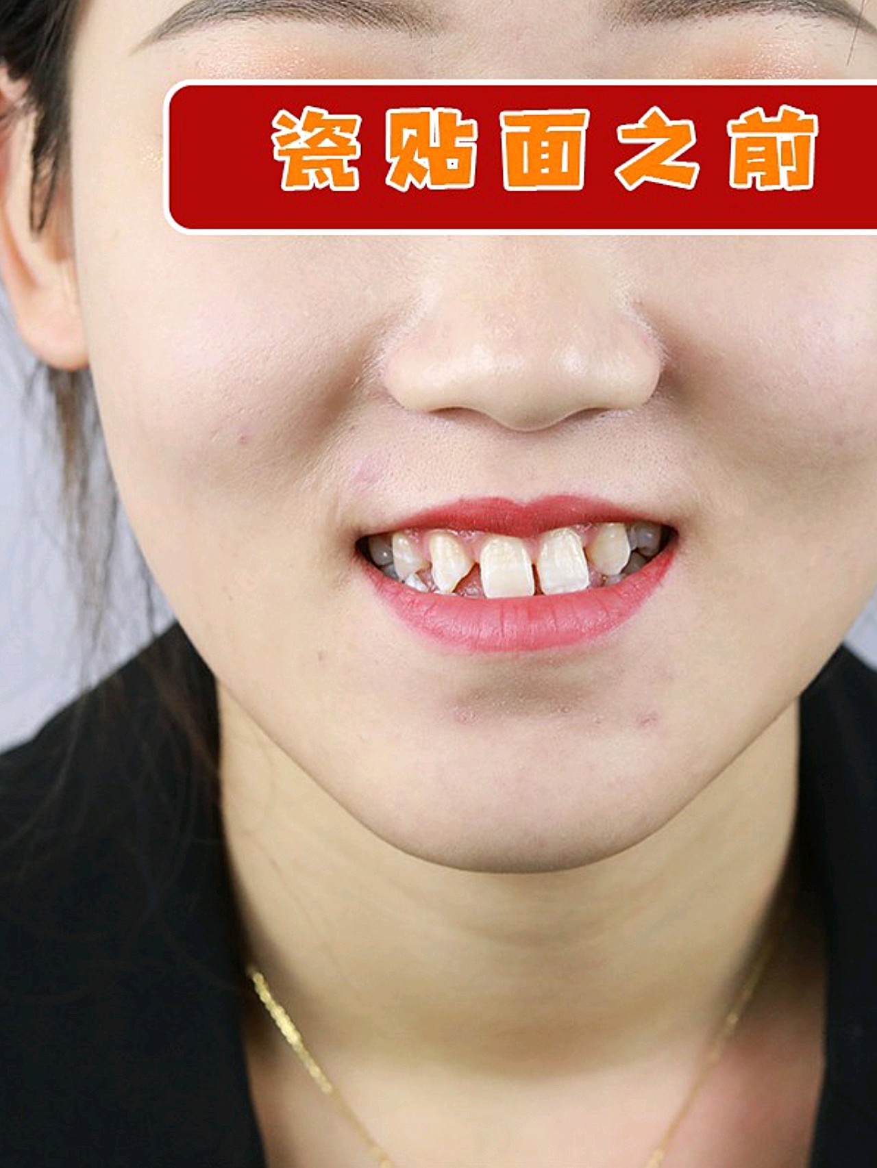 牙齿缝隙大的女人面相图片