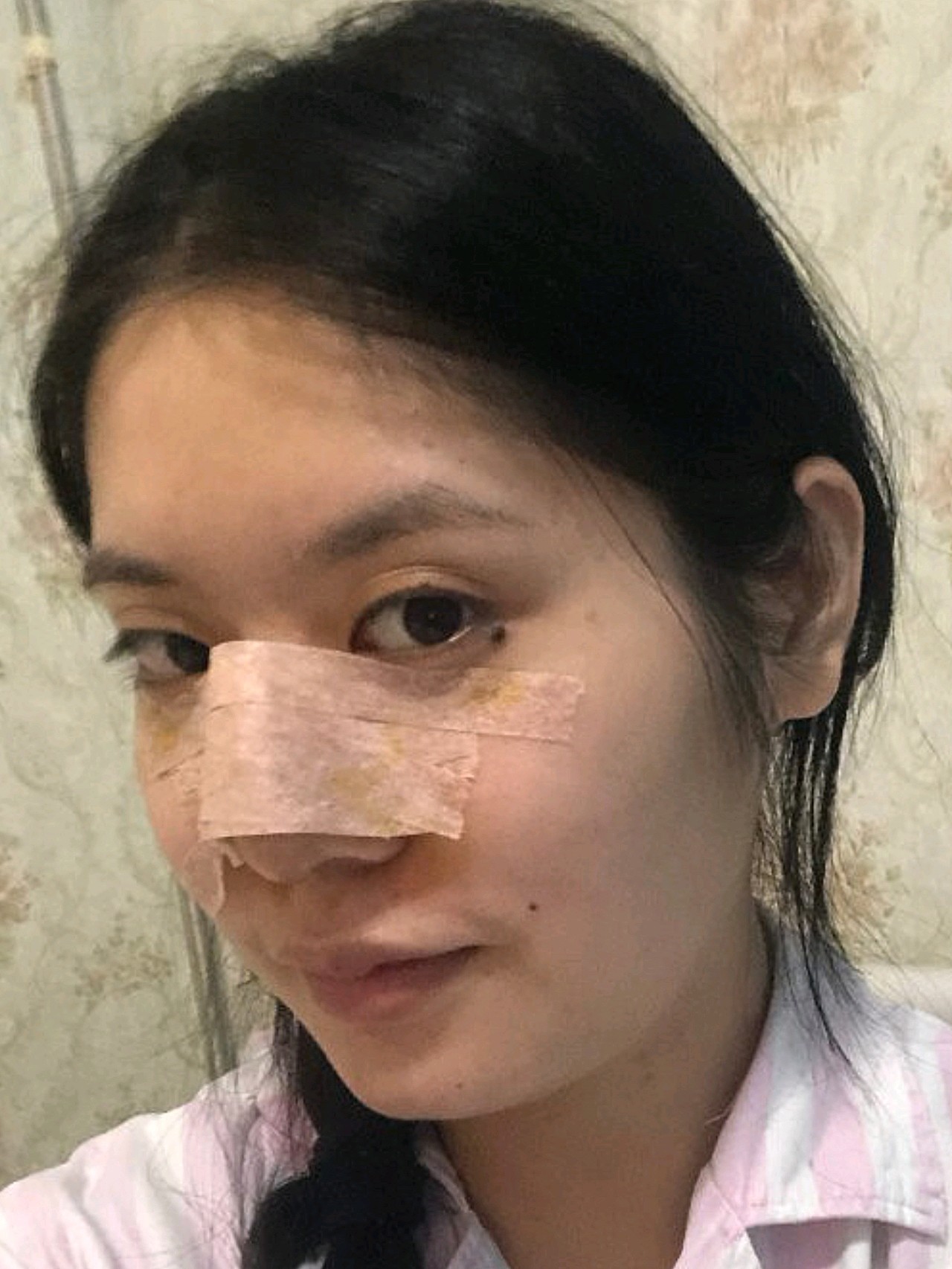我发现以前我的鼻子不好看,可能是因为和我的五官协调性不够.