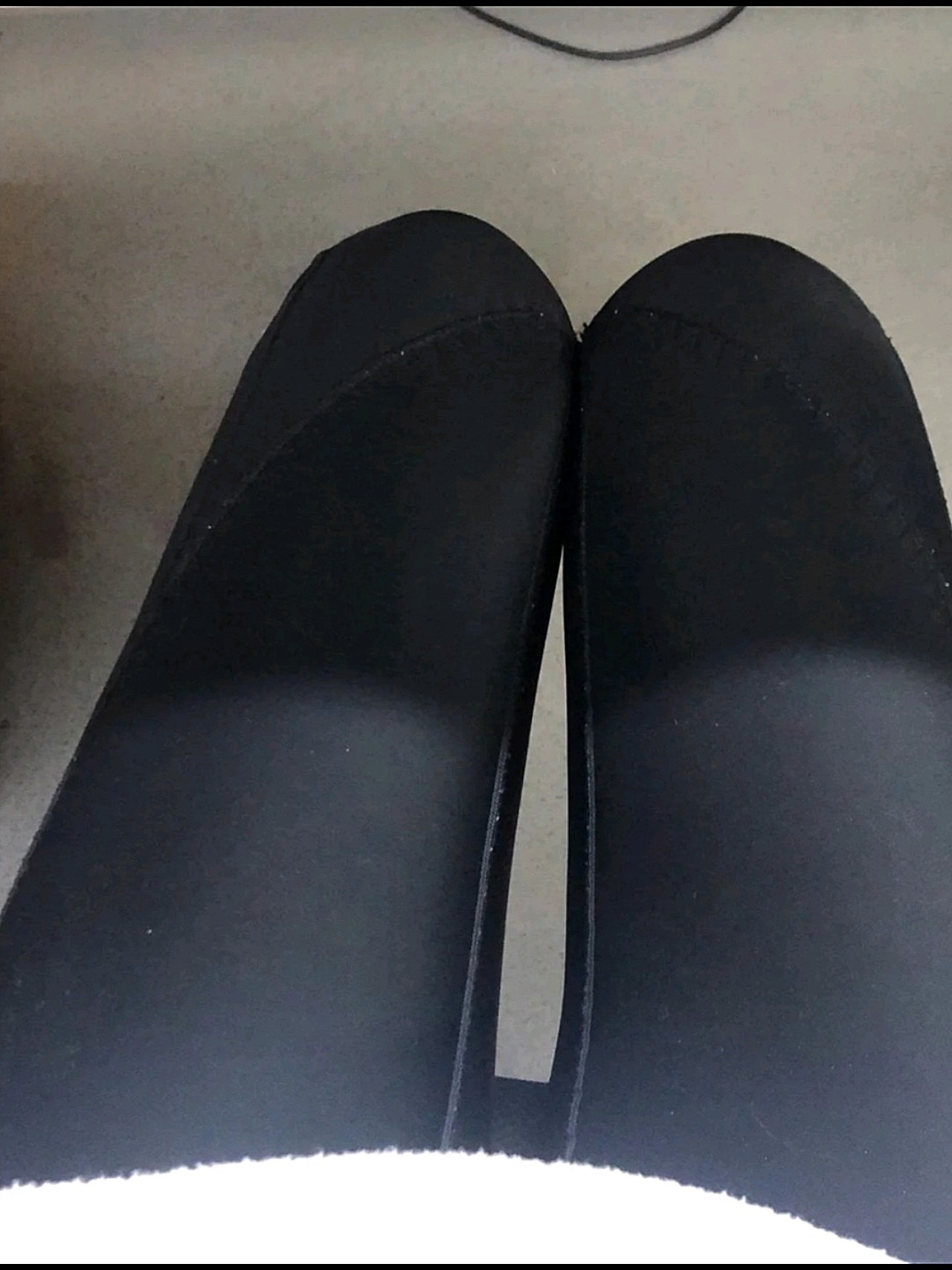 手术不痛,而且不算很紧张,只有一开始很紧张,后面慢_圈子-新氧美容