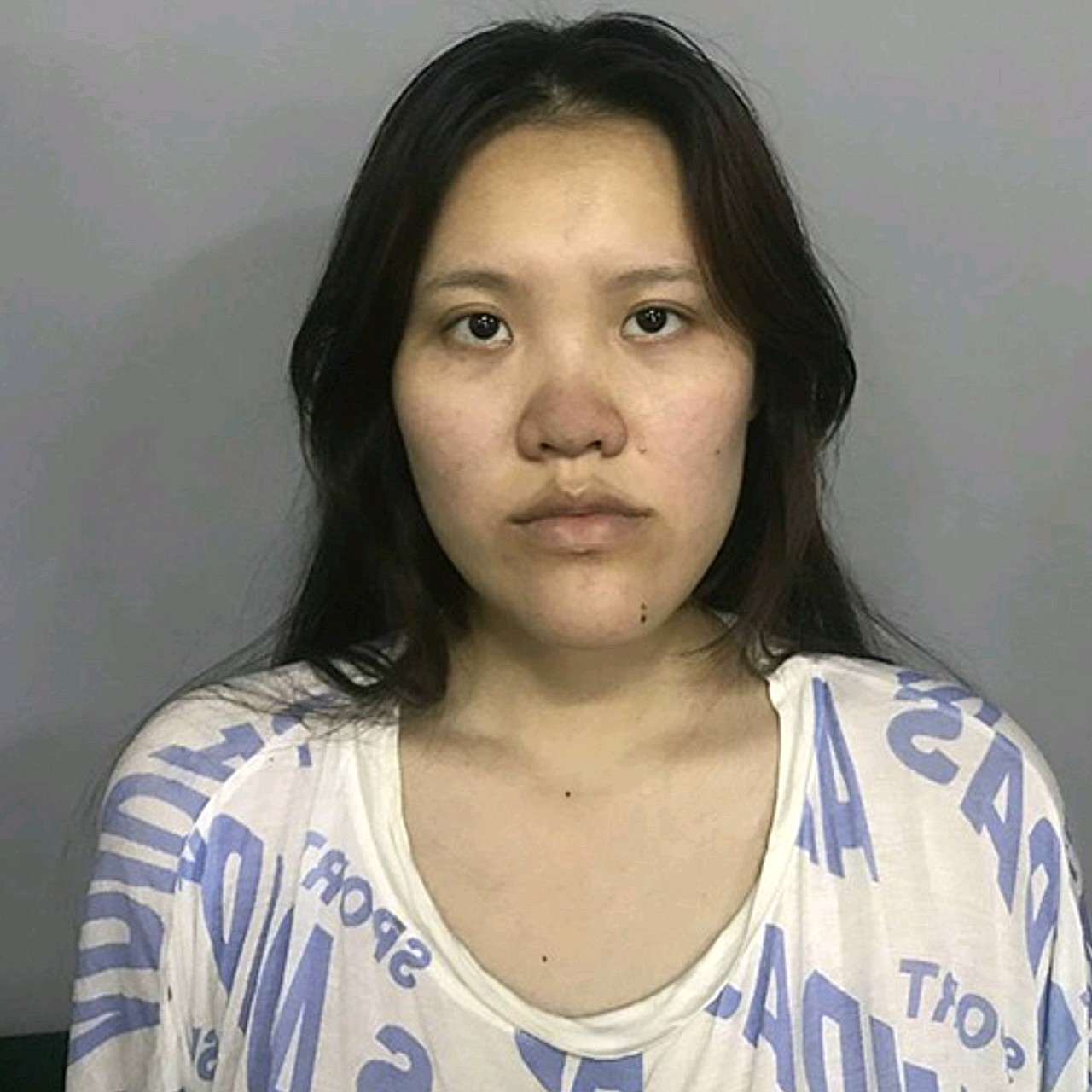 女孩子本身鼻部条件不算太好,鼻头圆钝,鼻翼宽,山根_圈子-新氧美容