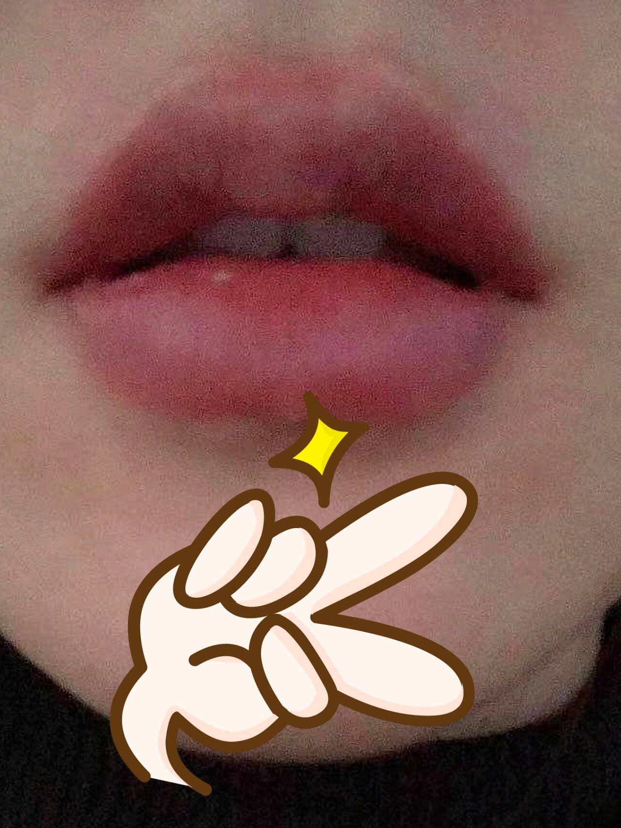 朋友在这边做的m唇,蛮好看的,忍不住也来做了一个,_圈子-新氧美容整形