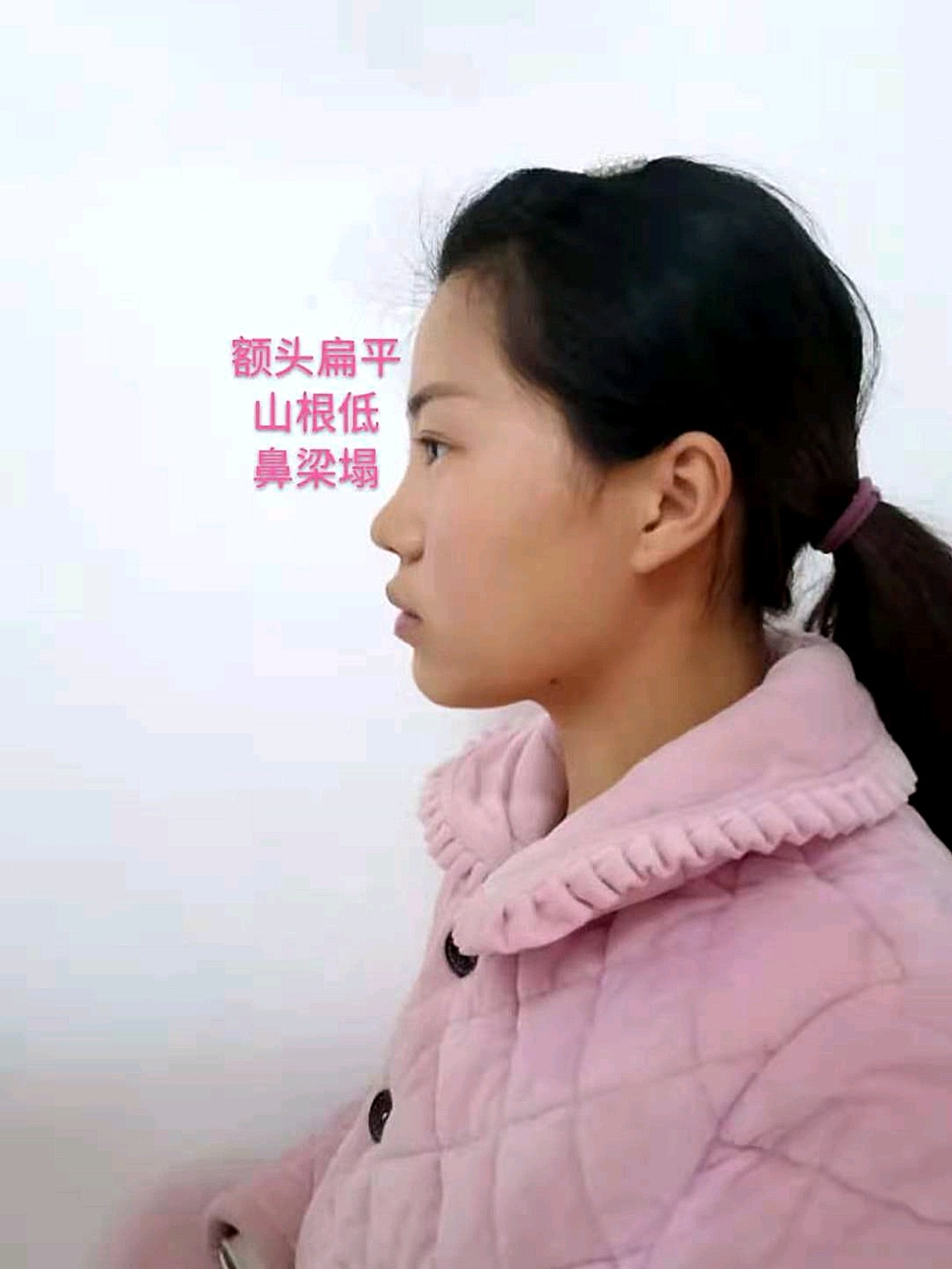 面相显土的特征有哪些?