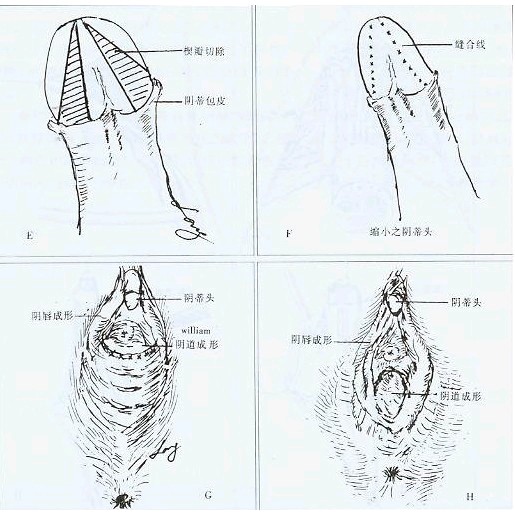 海贼王茵蒂图片