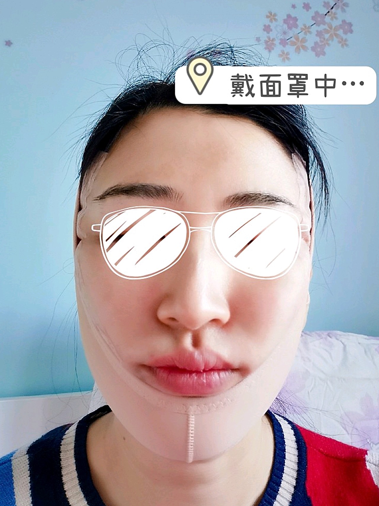 新氧体验官秘特线雕