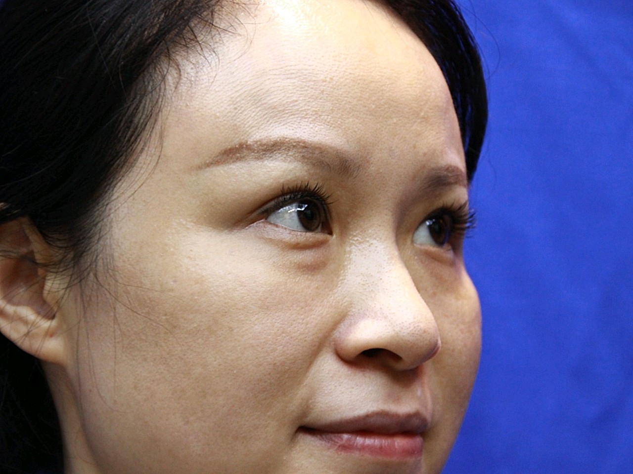 点的黑眼圈一点眼袋一点泪沟一点皮肤下垂一些干纹细纹应该是数全了吧