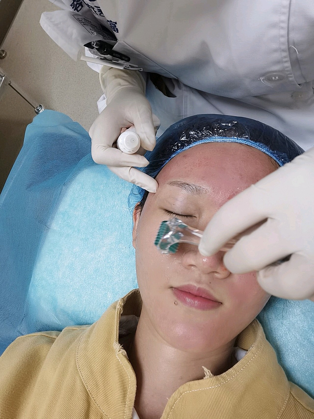 今天来做了胶原微针,中午的时候人没那么多,不像其他评论里说的要排队