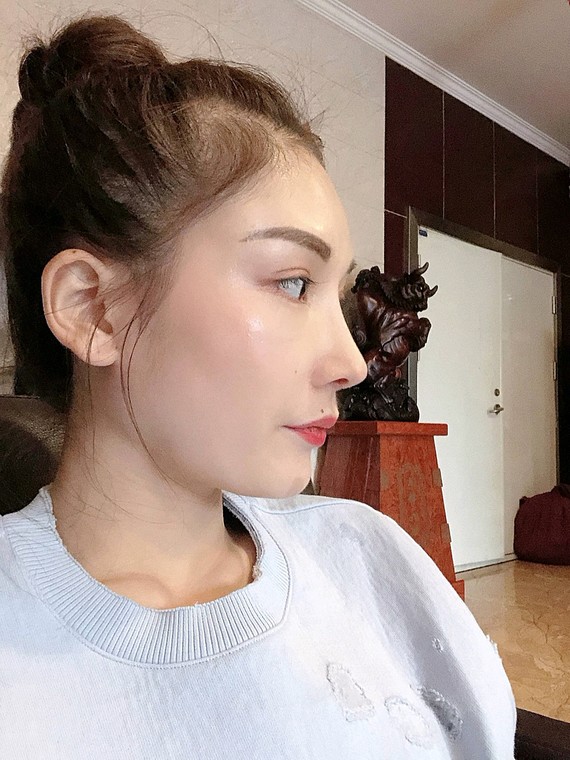 0202这个笔直高挺的鼻子属于我了,准备带它回去过除夕_圈子-新氧