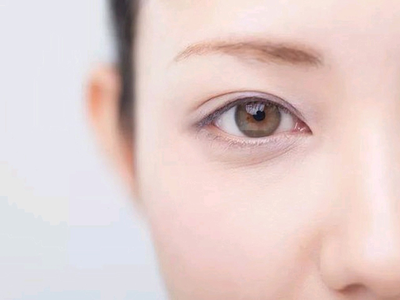 眼周抗衰!我为什么推荐你一定要做嗨体?嗨体是首款通_圈子-新氧美容整