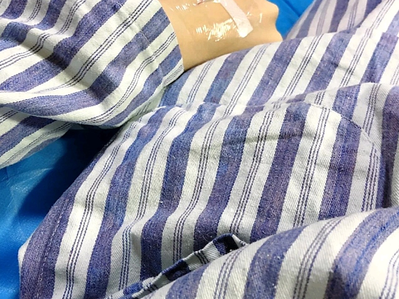 躺在医院的床上很无聊,来记录一下,我是昨天做的手术_圈子-新氧美容