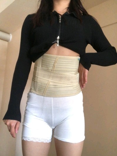 【术前诊断】:腹部脂肪多,站立时腹部凸起【方案设计_圈子-新氧美容