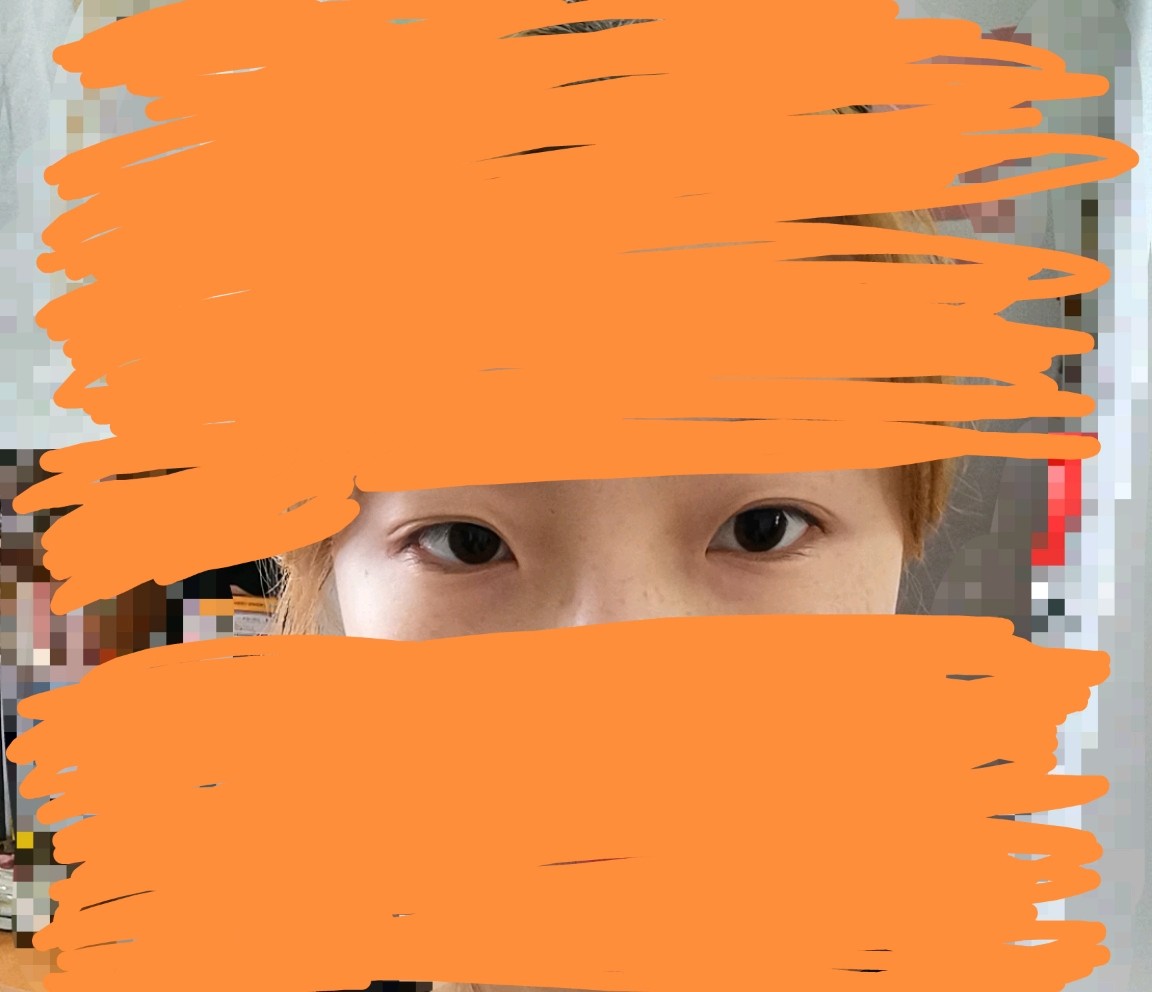 眼睛短怎么能变长