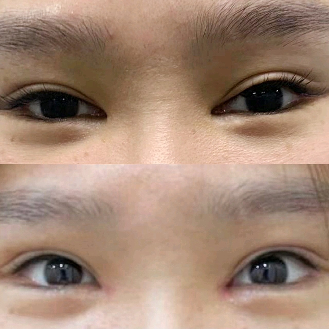 内眼角的回包,做的挺好.