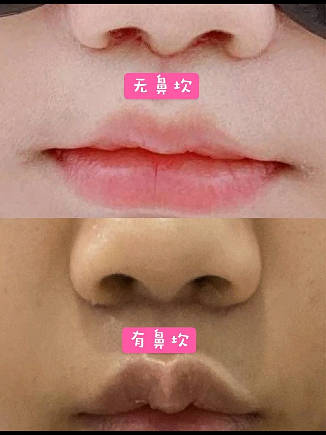 在专业的朋友的推荐下选择了靠谱的医院和医生做了这