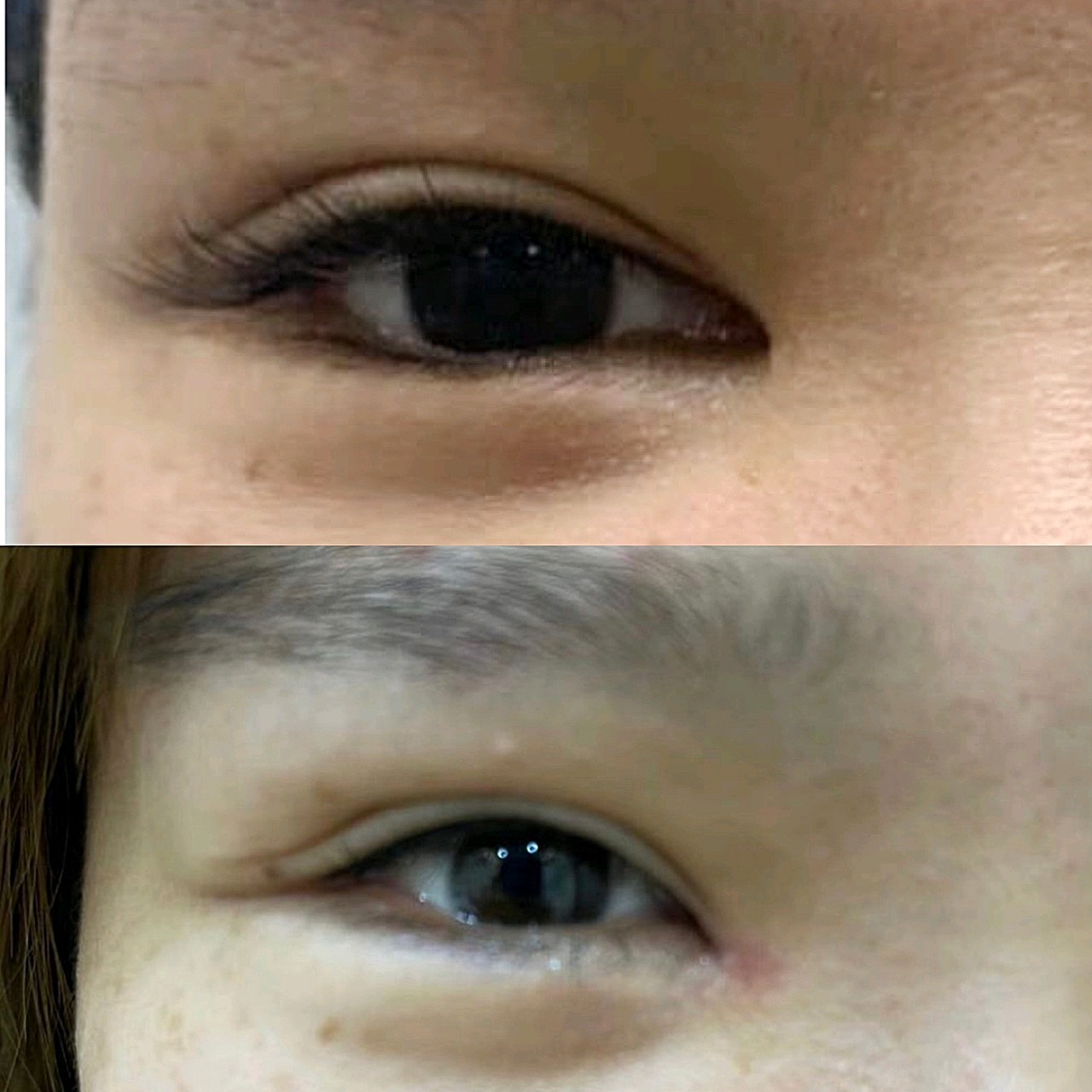 内眼角的回包,做的挺好.