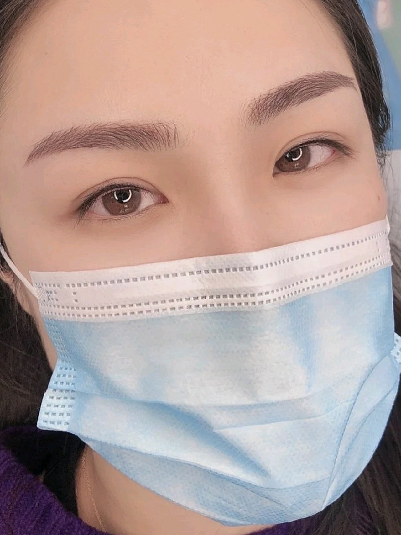 掉痂后的美瞳线和眉毛效果满意到爆炸呀,现在早上都可_圈子-新氧美容