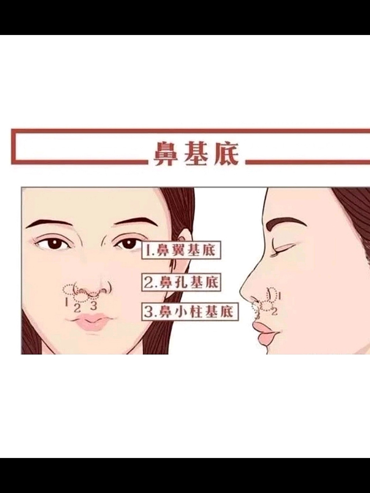 如何判断鼻基底凹陷必看功课