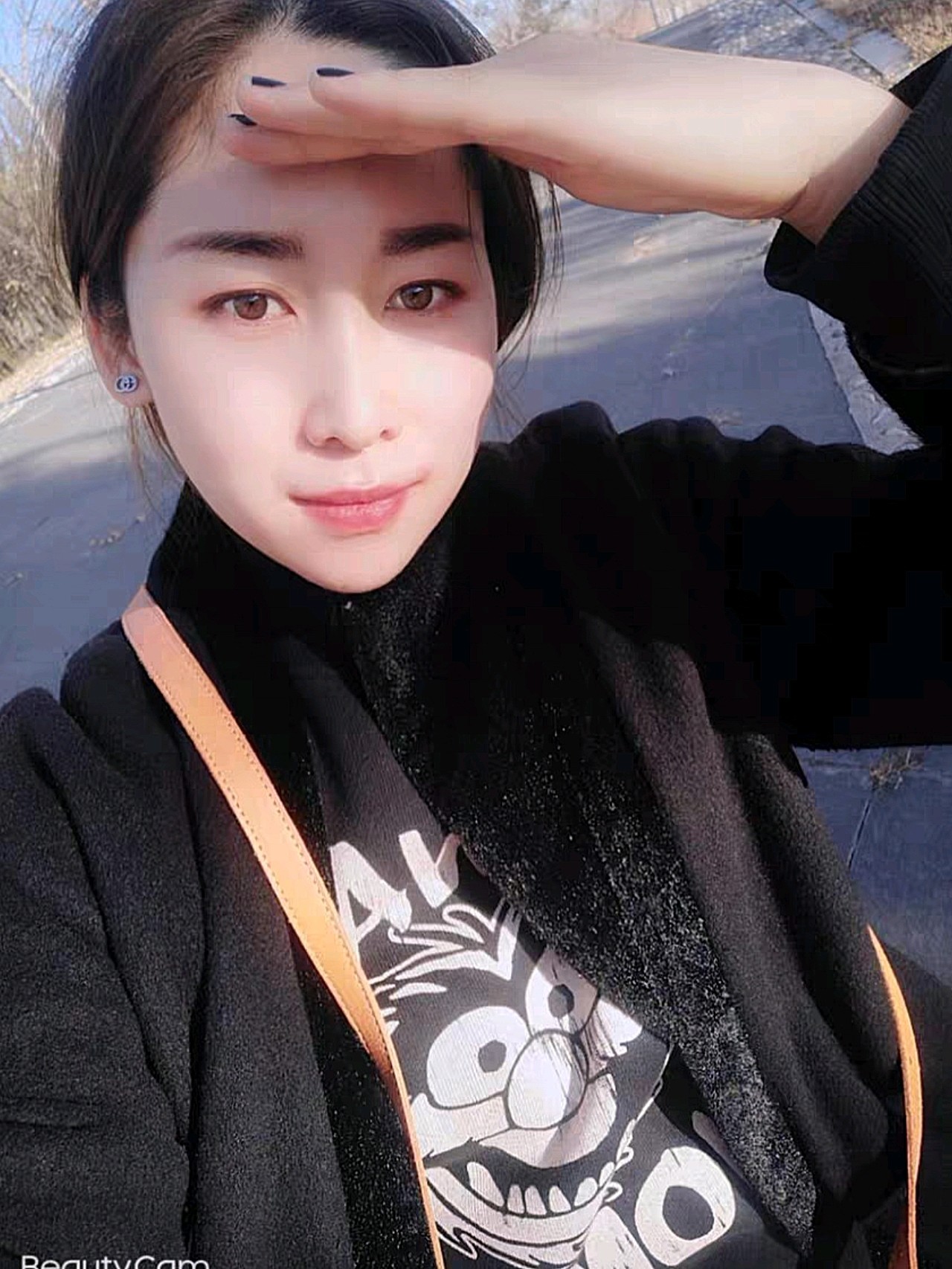 凸嘴如何矫正_矫正嘴凸有风险吗_矫正嘴凸大概要多少钱