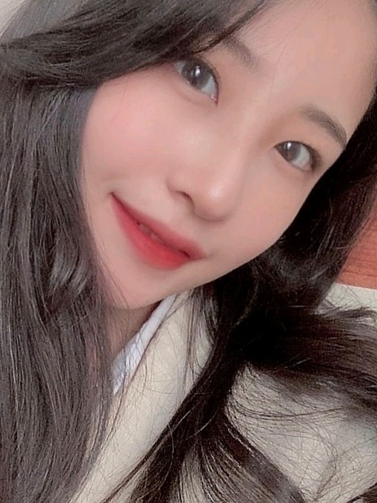 现在皮肤超白超嫩的,回家的时候我妈都不敢相信hhh_圈子-新氧美容整形