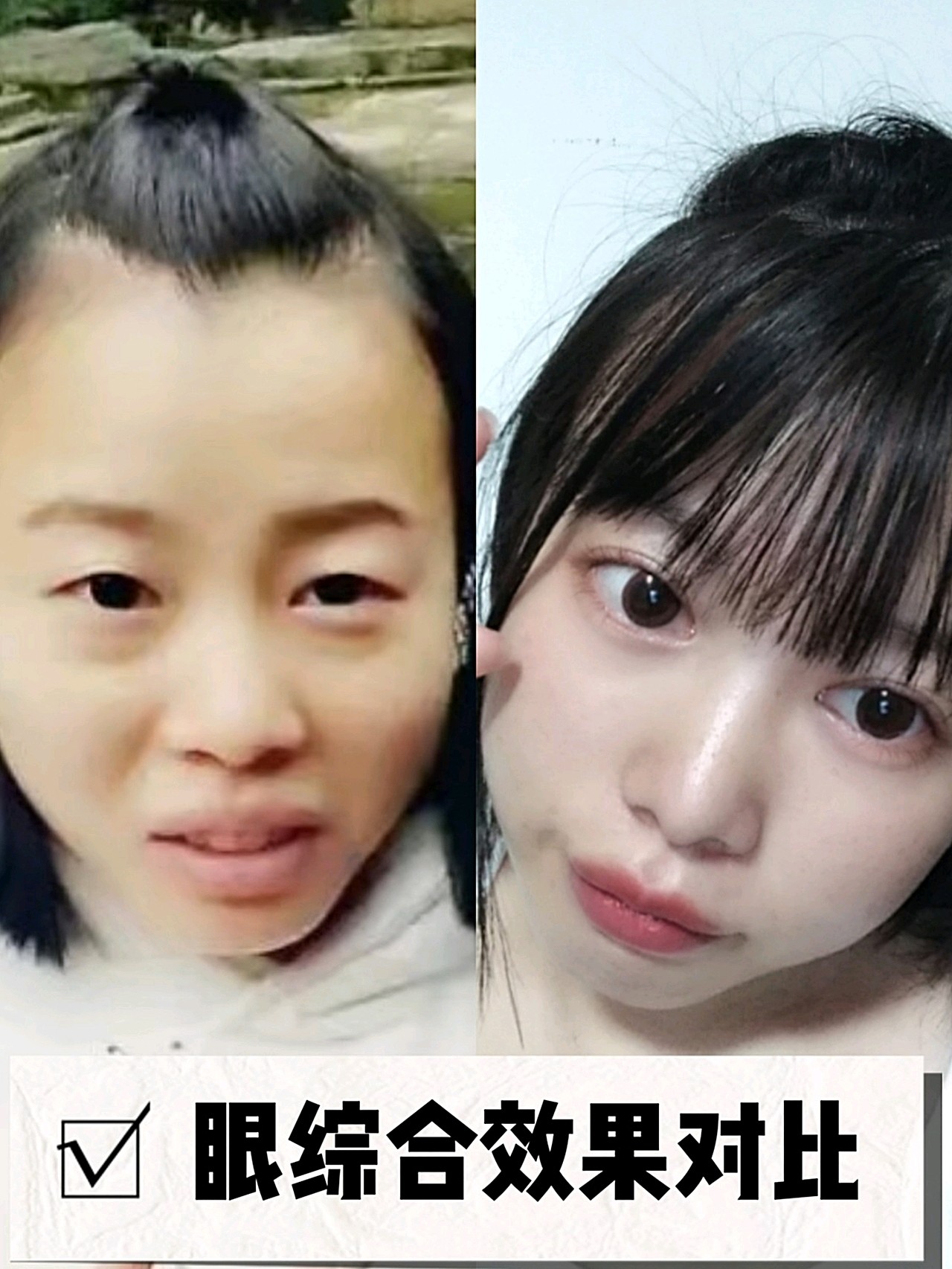 青春期的时候没有一点少女感,原本胶原蛋白满满的婴儿肥更是增添