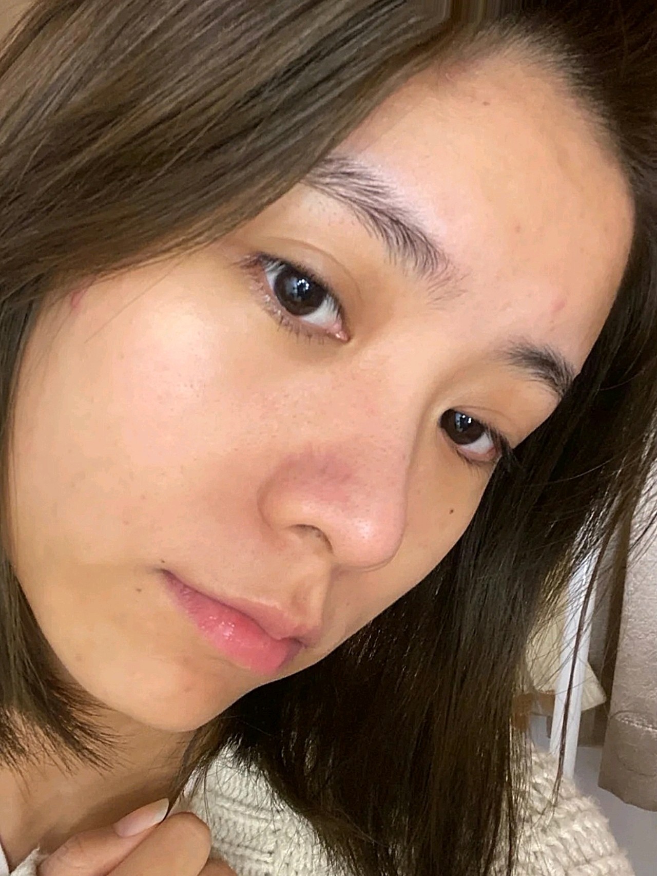 我是混干皮,t区油,其他部位巨干.肤色偏黑,小麦肤_圈子-新氧美容整形
