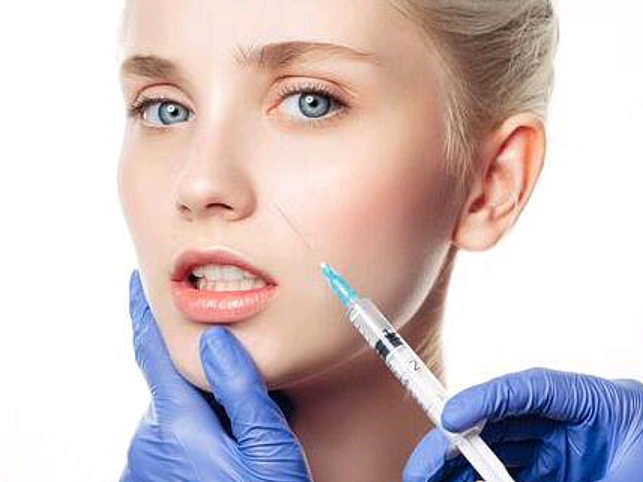 注射玻尿酸隆鼻