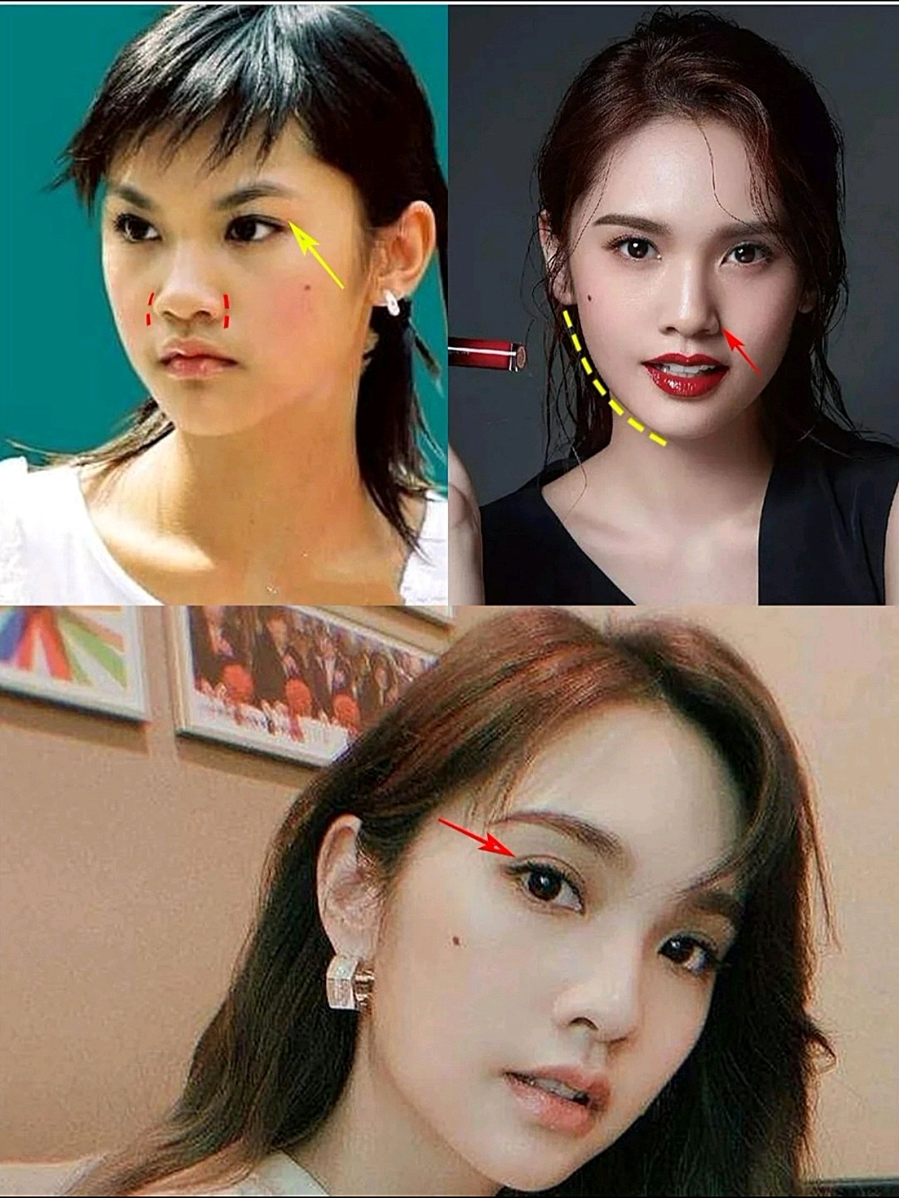 杨丞琳不仅恋爱运好,整形运才是真的绝