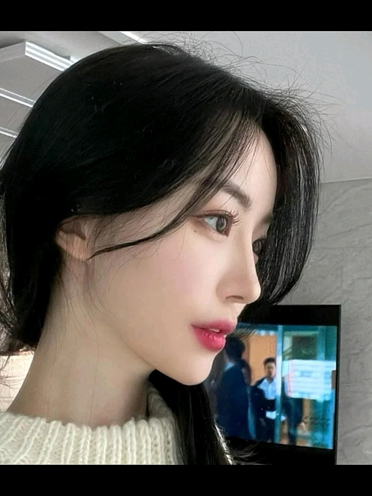 鼻子恢复的很自然,特别的挺翘喜欢侧面,是不是很漂亮_圈子-新氧美容