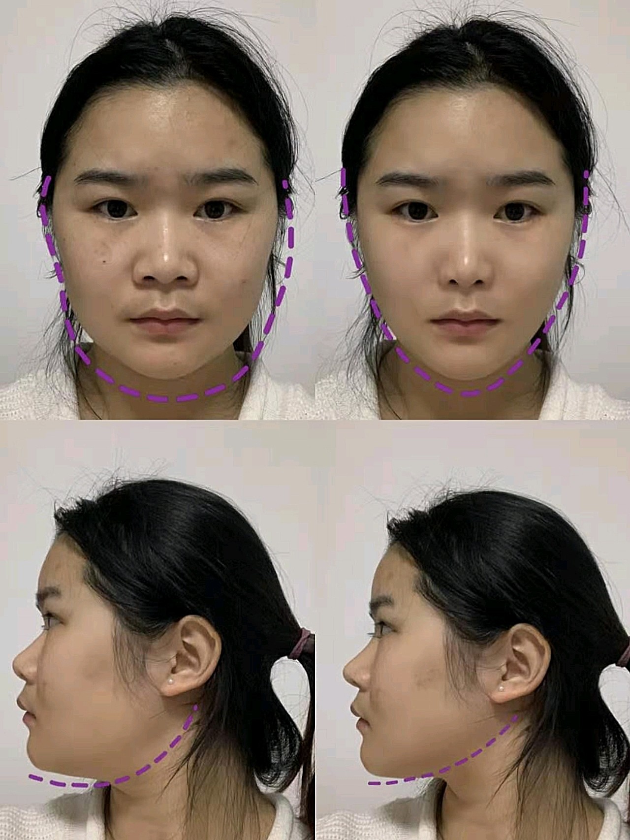 胖瘦对人的改变有多大?