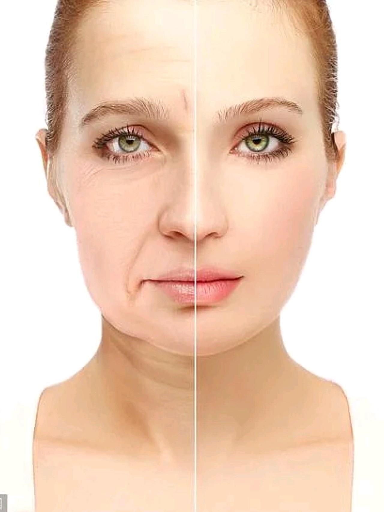 法令纹到底有多显老?