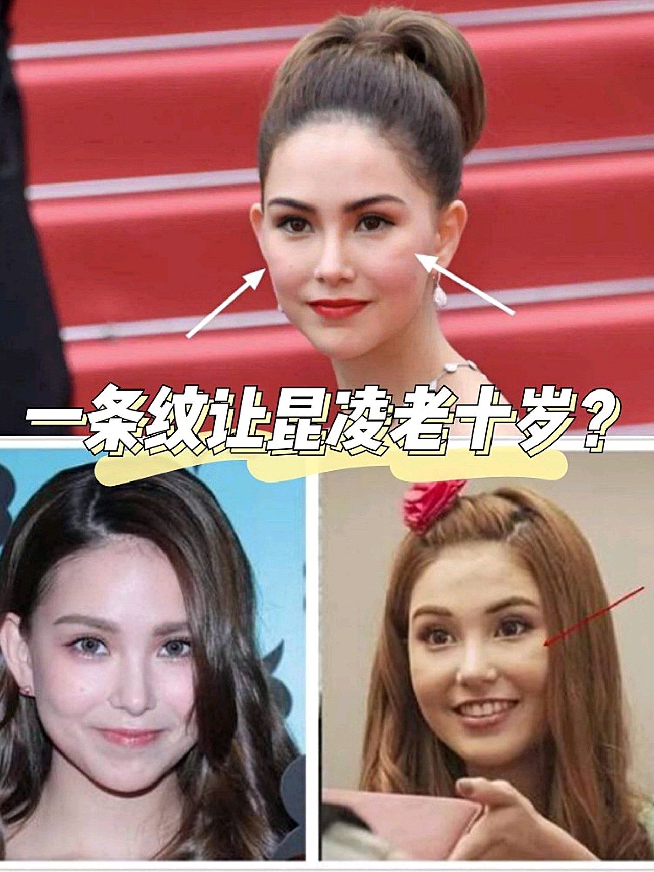 近日昆凌被吐槽像37岁,为什么显老?可以看到她在很_圈子-新氧美容整形