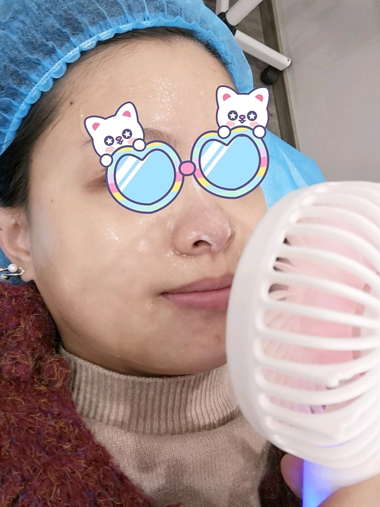 刷酸体验—效果显著