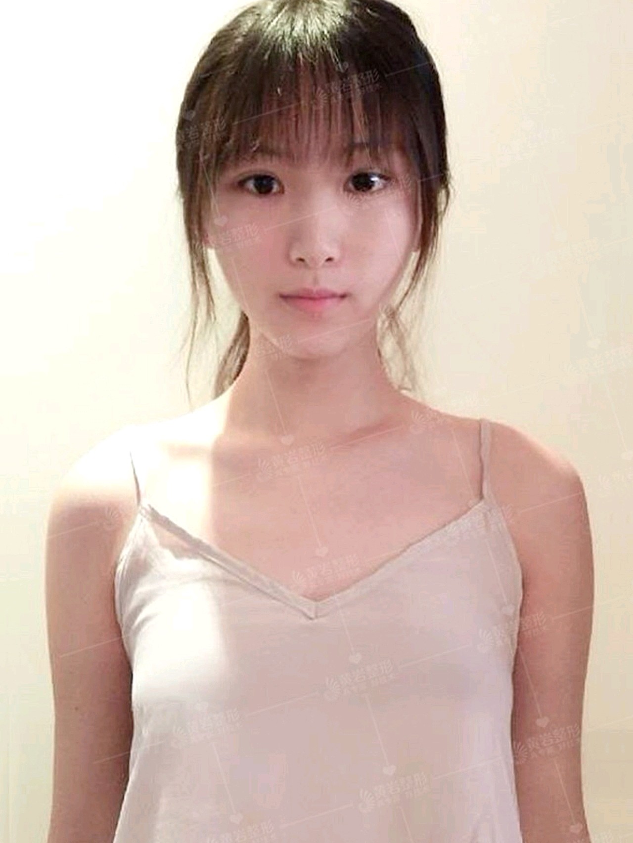 者专业胸部按摩,受术者前一个月要每日按摩两次,在第二个月可一天一次