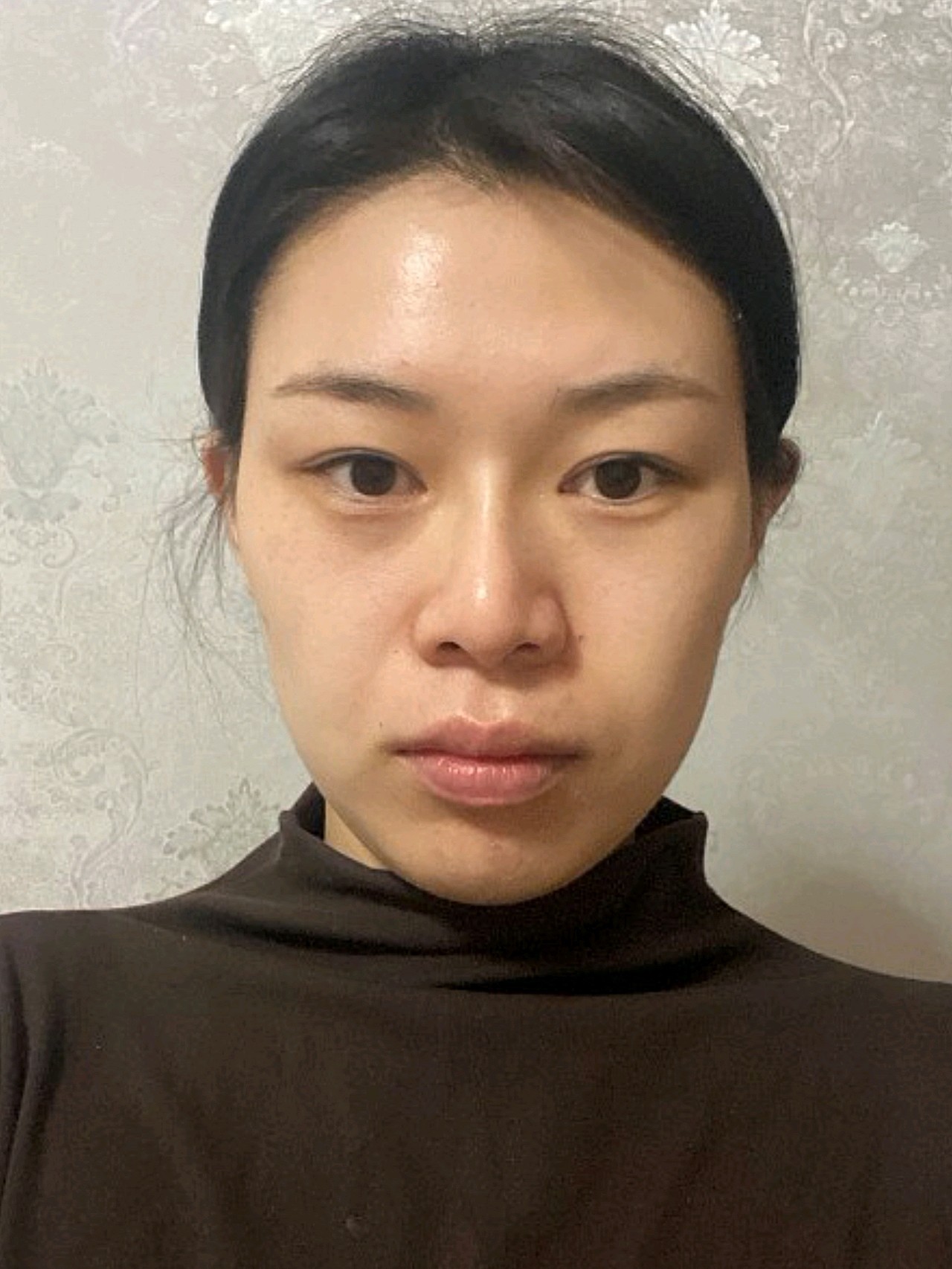 鼻子大,显得我法令纹好严重,好显老的样子,感觉比我_圈子-新氧美容