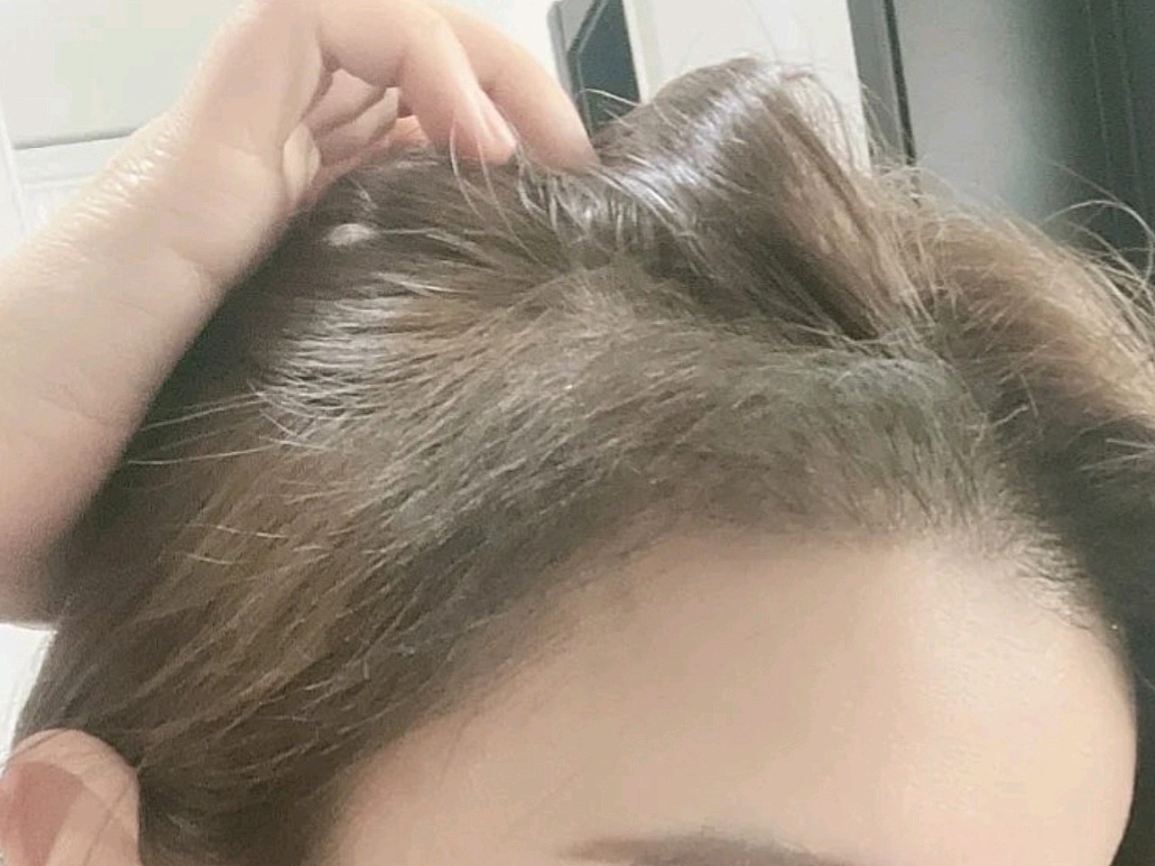 天冷了,头发披下来,发现头顶没有之前那么浓密了,赶_圈子-新氧美容