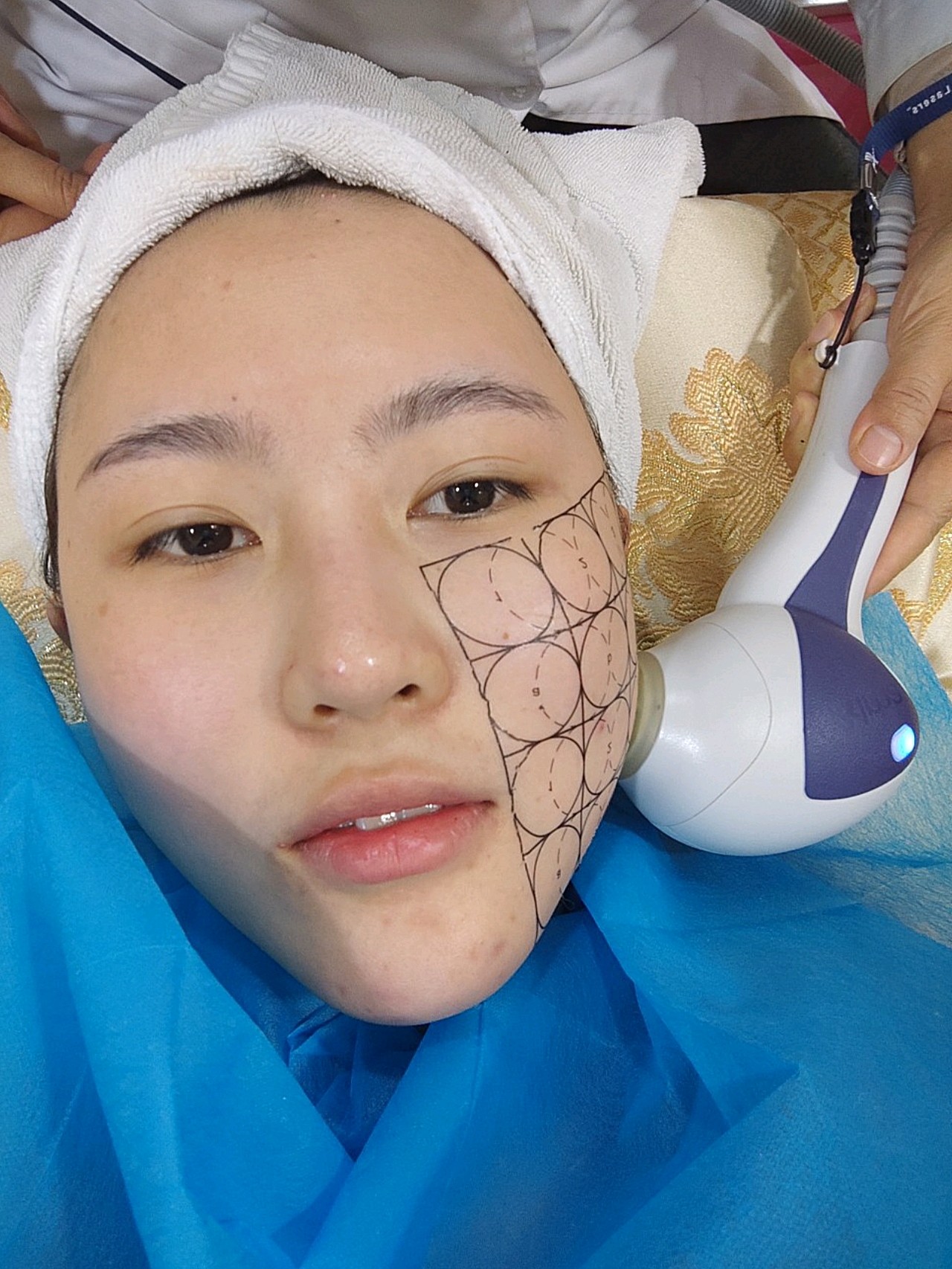 热拉提做多少次才有效果(热拉提做多少次才有效果呢)