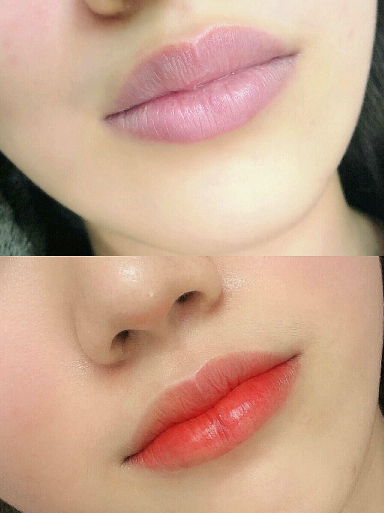 我最近一直被人夸唇部好看,咱也不敢说,其实我之前是_圈子-新氧美容